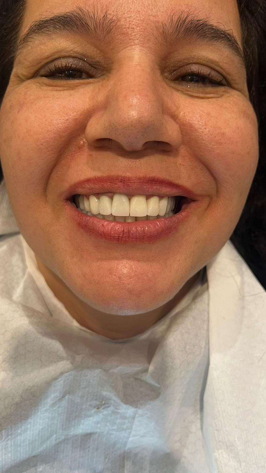 ECE Dental Patient Transformation